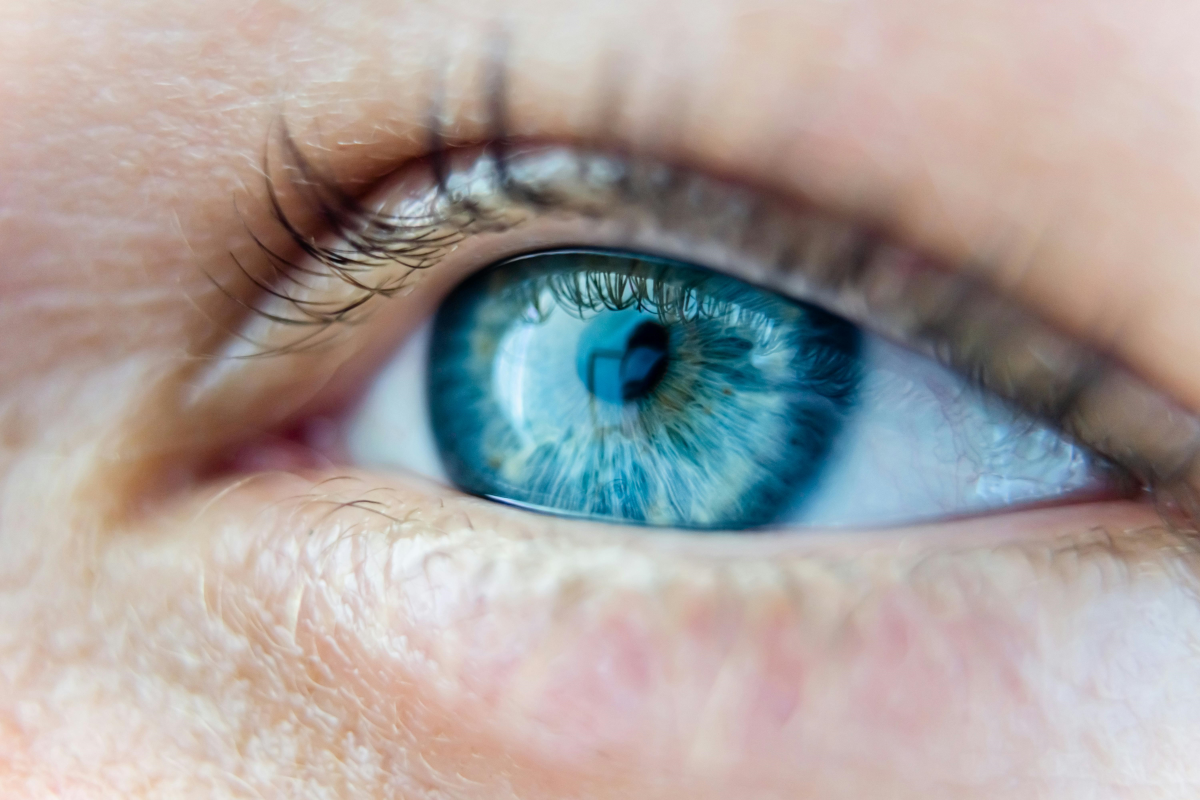 Do You Need a Prescription for Coloured Contact Lenses?
